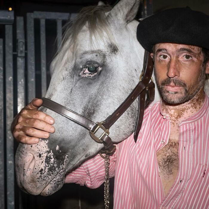 Man with vitiligo and horse with similar white patches, highlighting pets and their humans looking shockingly alike