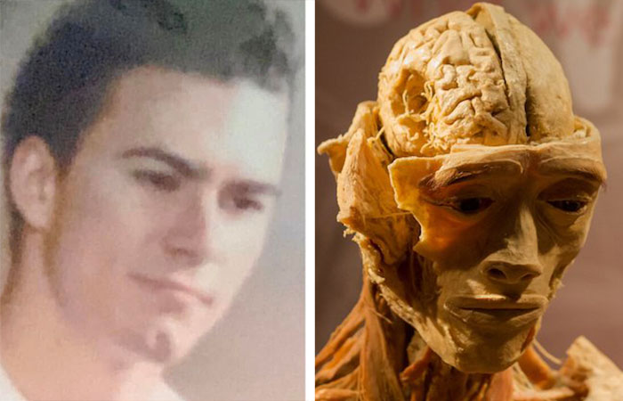 Side-by-side images showing a young man’s photo and a skinned human body display in a Las Vegas museum. Side-by-side images showing a young man’s photo and a skinned human body display in a Las Vegas museum.