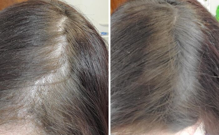  The Dreaded Post-Beanie Hair Reveal Won't Stand A Chance Against The Instant Fullness You'll Get From This Gowwim Hairline Powder 