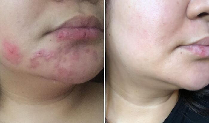  Prevent Your Skin From Entering Its Ancient Mummy Era This Winter With The Help Of This Bio-Oil Skincare Body Oil 