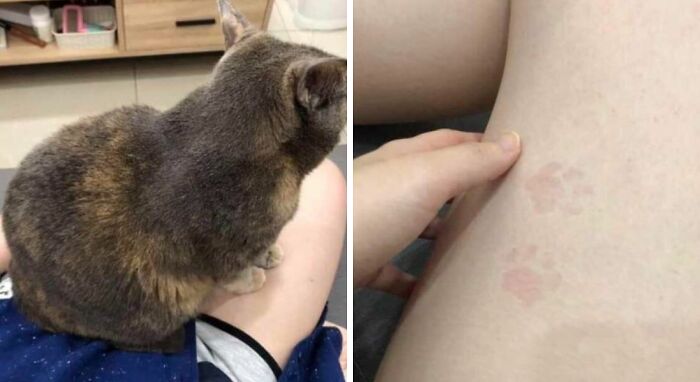 A pet cat sitting on a person's lap next to visible paw prints on their skin, showing loss of personal space.