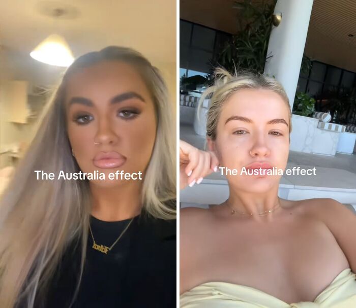 Before and after pics showing how Australia changes people with visible differences in appearance and lifestyle.