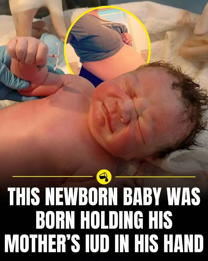 Newborn baby holding mother’s IUD in hand, illustrating a rare and surprising moment in the world of childbirth and birth control.