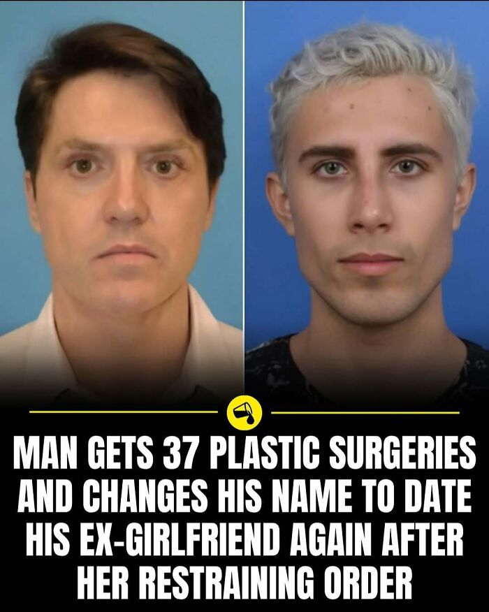 Before and after photos of a man who had 37 plastic surgeries, featured in Spill Now world-changing facts.