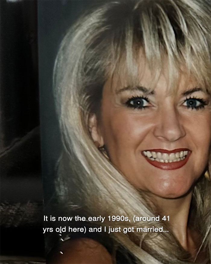 Woman shares aging progress with close-up portrait showing facelift results at 70 years old smiling happily. Woman shares aging progress with close-up portrait showing facelift results at 70 years old smiling happily.