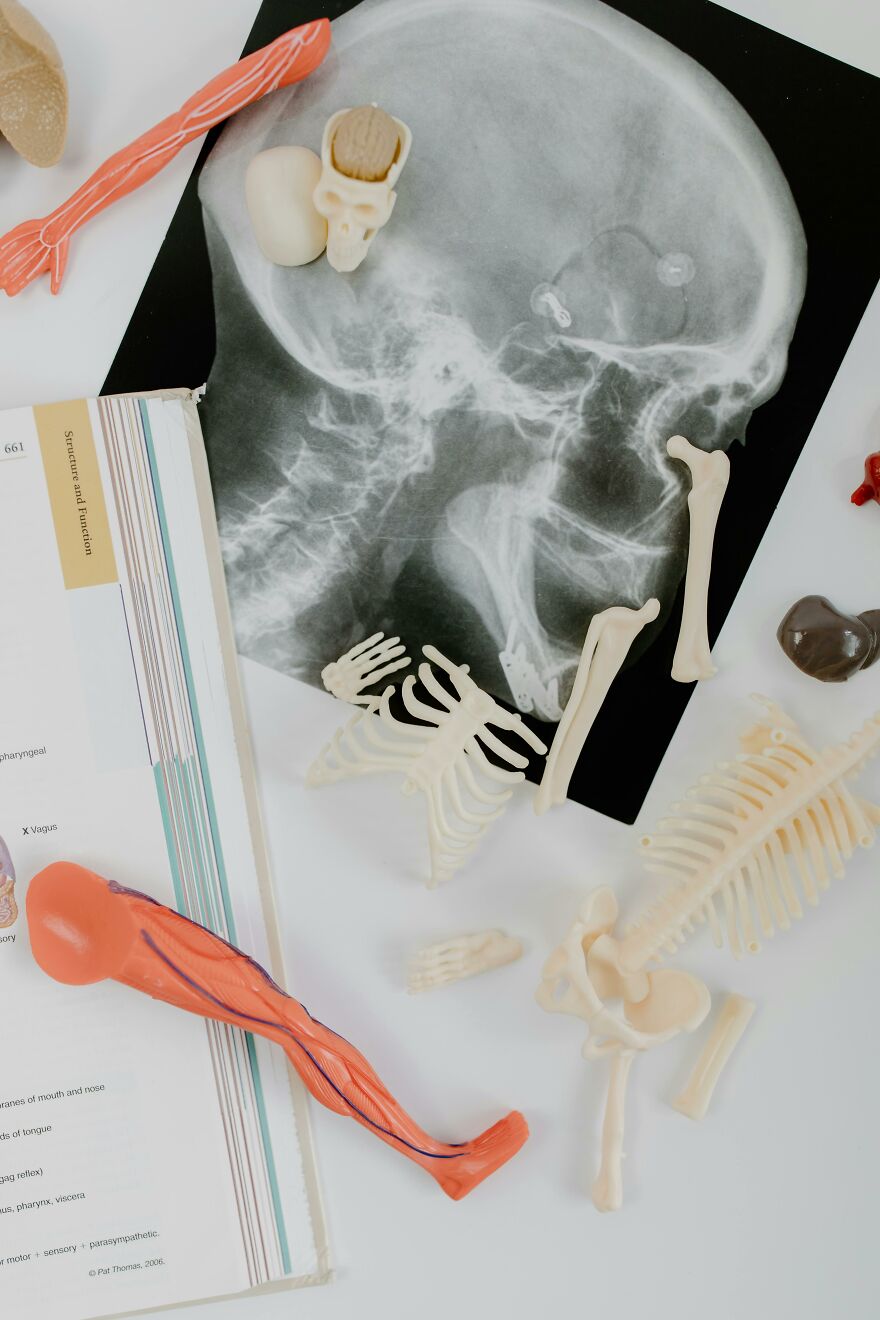 X-ray skull and scattered model bones with anatomy book, illustrating broken bone theory for superstition humor trend. X-ray skull and scattered model bones with anatomy book, illustrating broken bone theory for superstition humor trend.