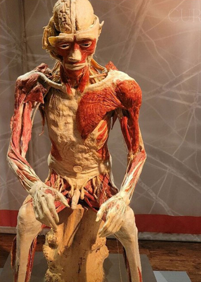 Skinned body exhibit displayed in Las Vegas museum, relating to mom claims discovery of her son's body on display. Skinned body exhibit displayed in Las Vegas museum, relating to mom claims discovery of her son's body on display.