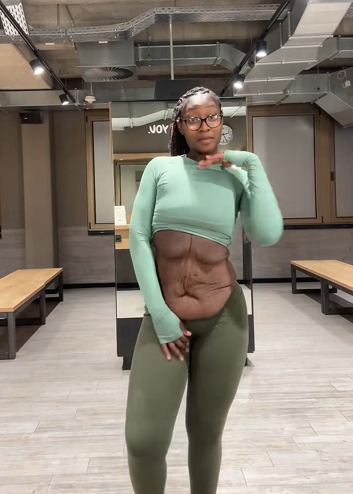 Woman in workout clothes showing loose skin on her belly after massive weight loss in a modern gym setting.