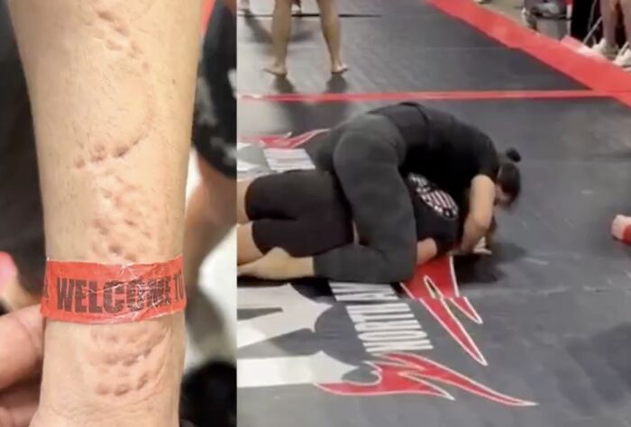 “Completely Insane”: Jiu-Jitsu Athlete Brutally Bitten By Opponent During Match In Viral Video “Completely Insane”: Jiu-Jitsu Athlete Brutally Bitten By Opponent During Match In Viral Video
