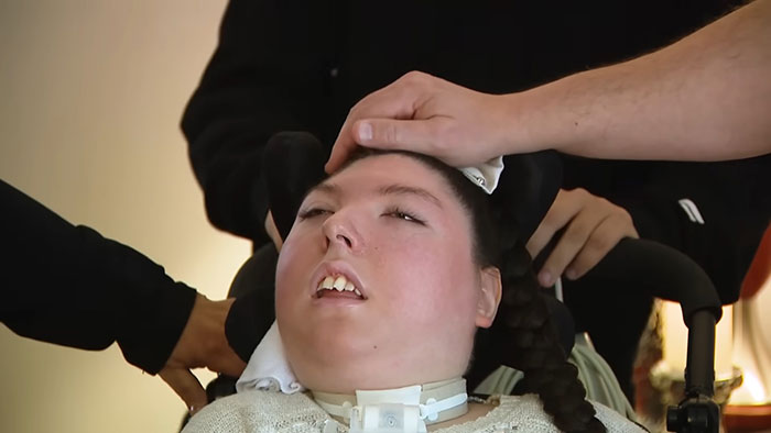 Young woman born without most of her brain lying in a wheelchair as family members care for her at home. Young woman born without most of her brain lying in a wheelchair as family members care for her at home.