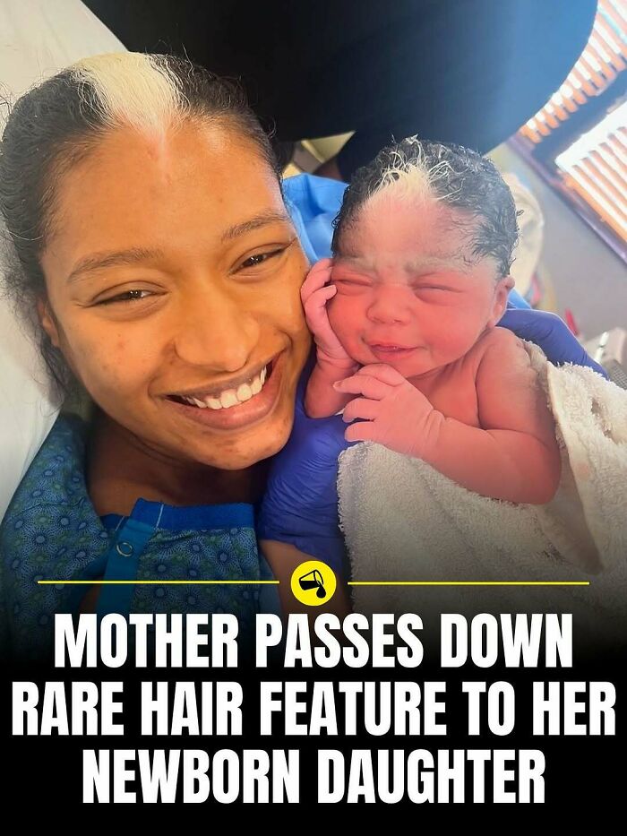 Mother and newborn showing rare hair feature passed down, highlighting unique traits in our world spill now photos and facts.