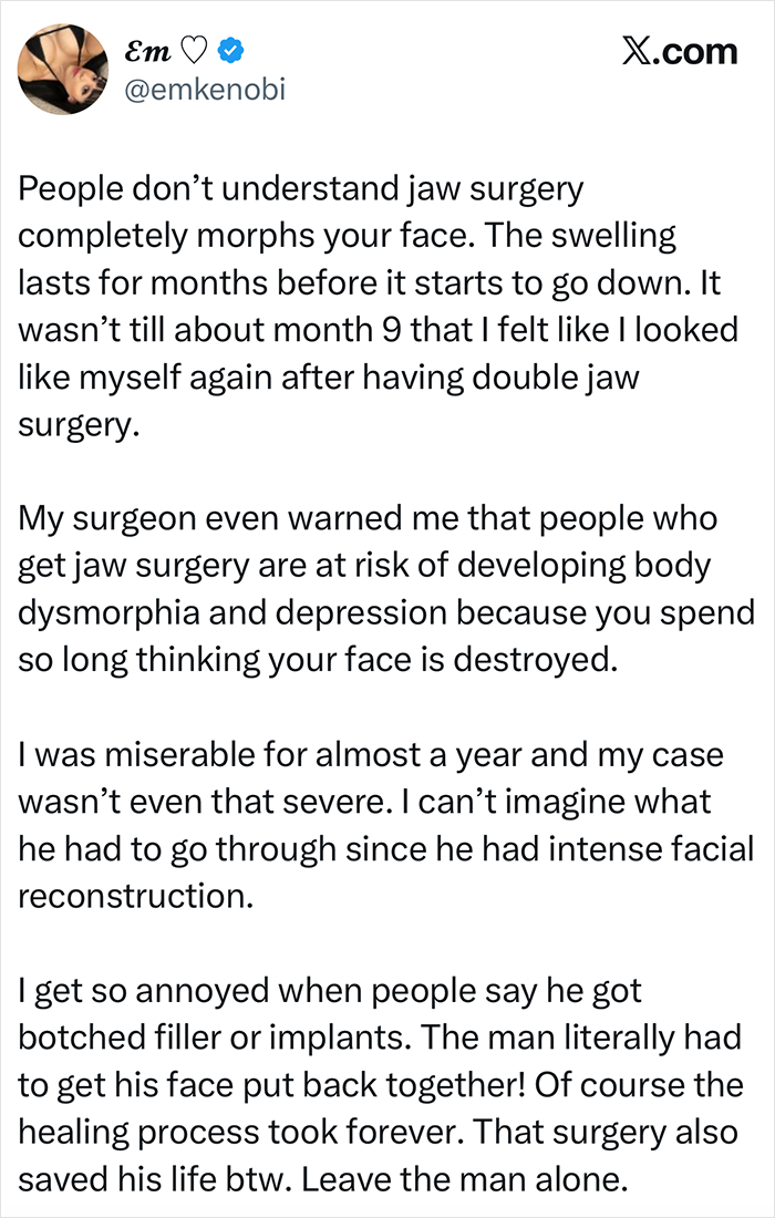 Zac Efron's 'Back to Normal' Face Has Everyone Talking As Expert Weighs In On What Happened Zac Efron's 'Back to Normal' Face Has Everyone Talking As Expert Weighs In On What Happened