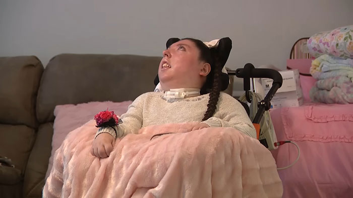 Young woman born without most of her brain sitting in a wheelchair covered with a pink blanket indoors at home. Young woman born without most of her brain sitting in a wheelchair covered with a pink blanket indoors at home.