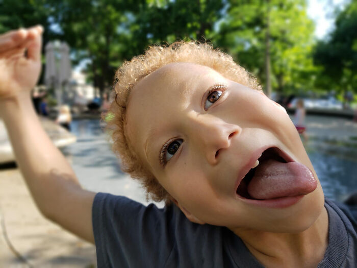 Close-up of a child making a funny face outdoors, illustrating the insane things patients said or did under anesthesia effects.