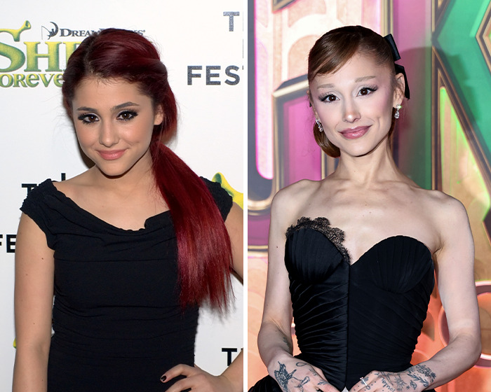 That's Called Tons Of Surgery": Concern Grows Over Ariana Grande's  Transformation | Bored Panda