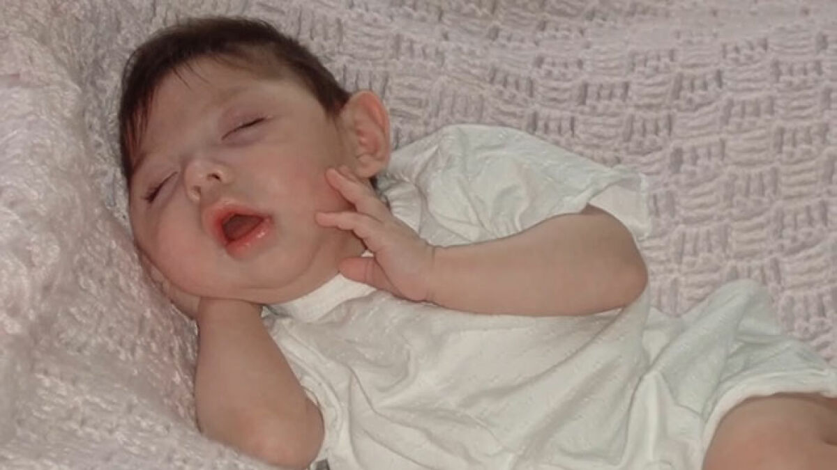 Baby girl sleeping peacefully wrapped in a white blanket, born without most of her brain, inspiring family and public debate.