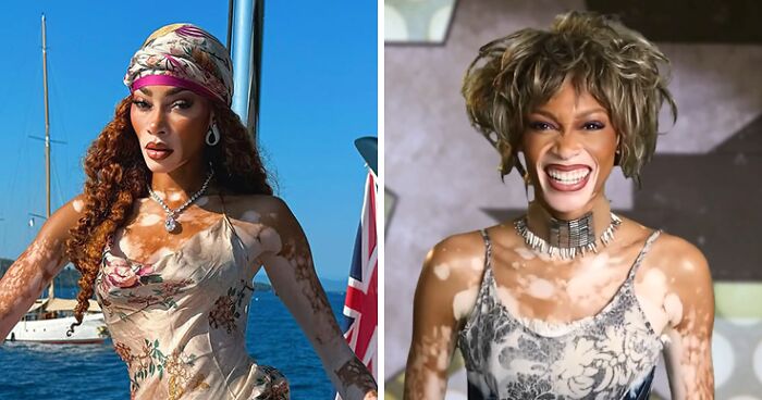 Winnie Harlow Breaks Silence After Massive Backlash Over ‘Disrespectful’ Whitney Houston Halloween Look