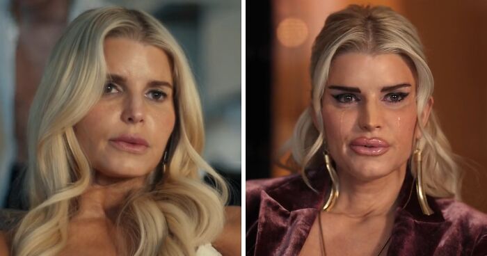 Jessica Simpson’s Botched Plastic Surgery For ‘All’s Fair’ Role Stuns Fans In Acting Return