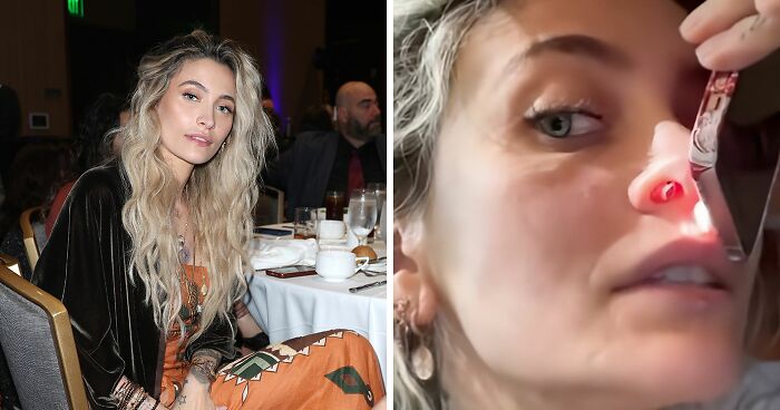 “It Ruined My Life”: Paris Jackson Reveals How Substance Use Deformed Her Face