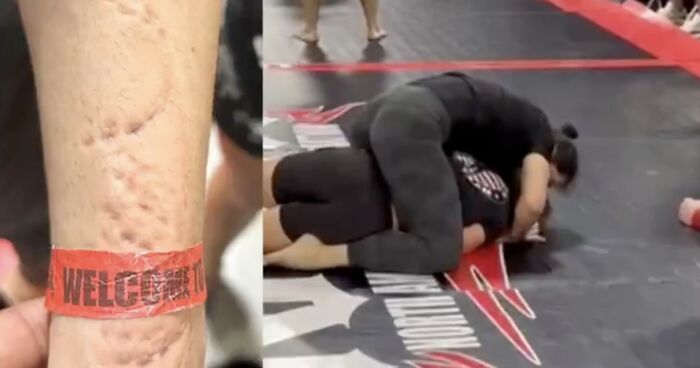 “Completely Insane”: Jiu-Jitsu Athlete Brutally Bitten By Opponent During Match In Viral Video