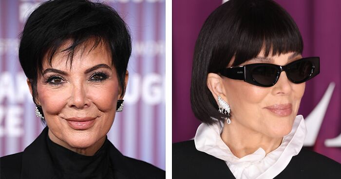 5 Warning Signs Hidden Behind The Facelift Craze, From A Surgeon’s Perspective