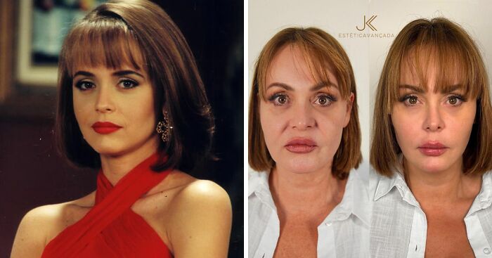 Fans Divided After Plastic Surgery Clinic Shares ‘Unrecognizable’ Before-After Pictures Of Actress