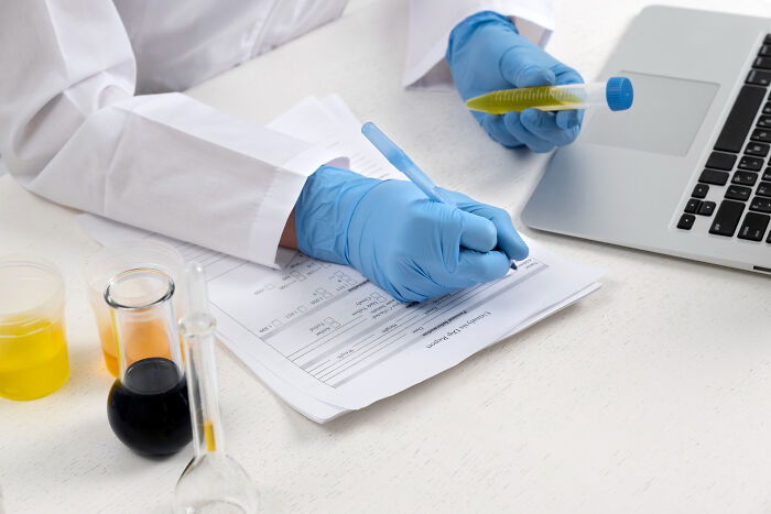 Doctor wearing blue gloves holding a test tube and writing notes by a laptop in a clinical lab setting.
