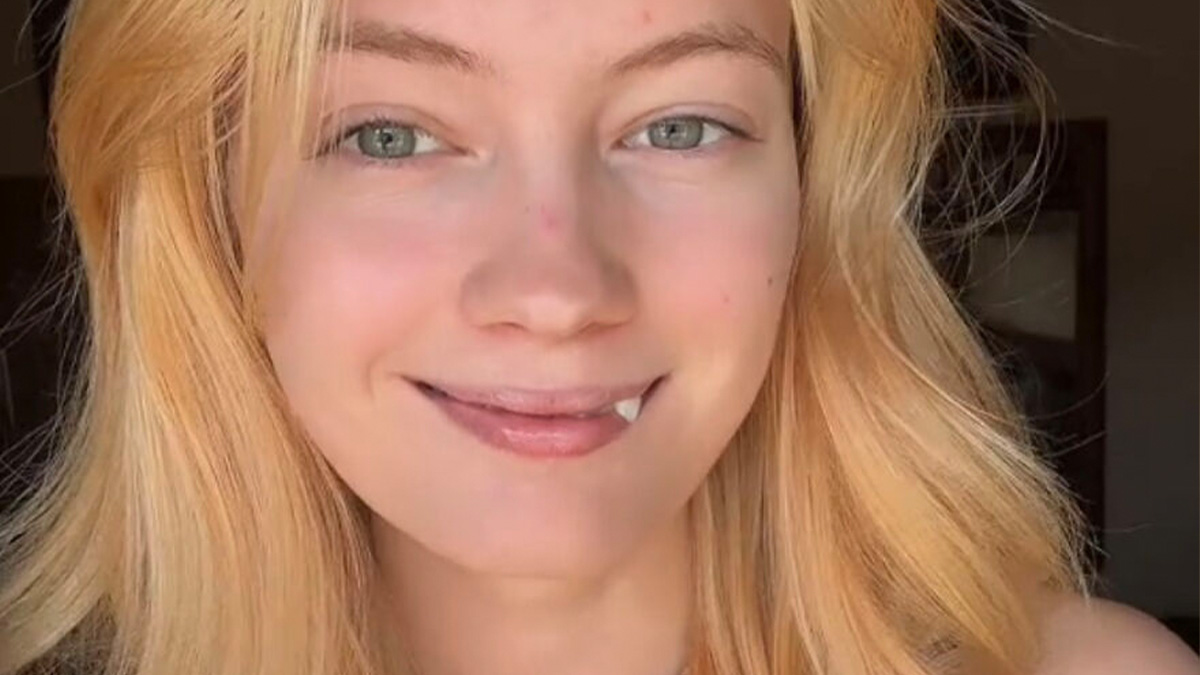 Young woman with blonde hair smiling, proudly showing her perfect imperfections in a wholesome trend.