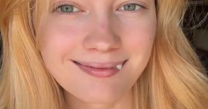 40 Beautiful Photos Showing People Celebrating What Makes Them Unique