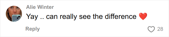 Woman with a prominent face tattoo sharing her story as a mental health advocate after dealing with personal issues.