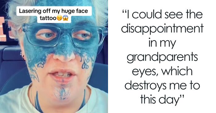 Brave Woman Shares Story Of Removing Unwanted Face Tattoo After Cruel Prank