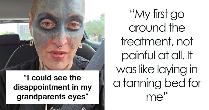 Woman Tries To Cover Up An Awful Tattoo She Didn’t Consent To, Now Shares The Removal Process