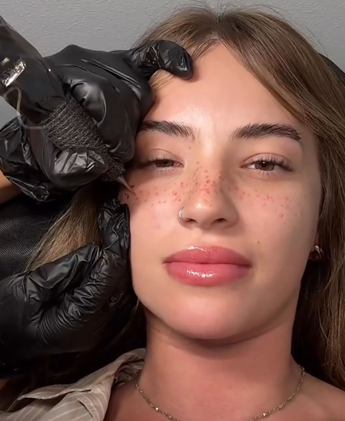 Woman getting freckles tattooed on her face by a professional artist wearing black gloves in a close-up beauty procedure. Woman getting freckles tattooed on her face by a professional artist wearing black gloves in a close-up beauty procedure.
