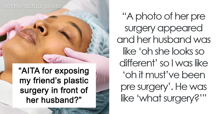 “AITA For Exposing My Friend’s Plastic Surgery In Front Of Her Husband?”
