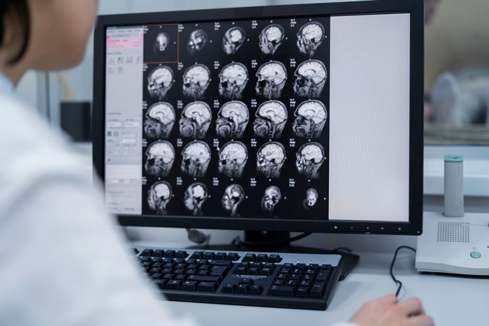 Medical professional reviewing brain scans on a computer screen, highlighting obsession linked to a life-threatening condition. Medical professional reviewing brain scans on a computer screen, highlighting obsession linked to a life-threatening condition.