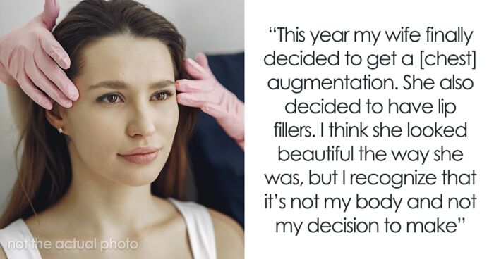 Man Struggles To Accept ‘New Wife’ After Plastic Surgery, Gets Honest When She Asks Him What He Thinks