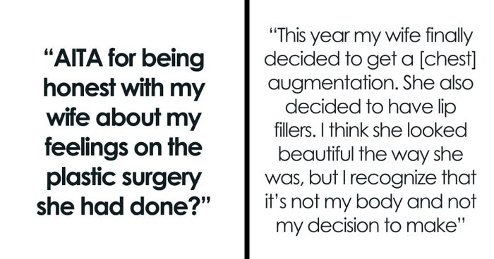Man Struggles To Accept ‘New Wife’ After Plastic Surgery, Gets Honest When She Asks Him What He Thinks