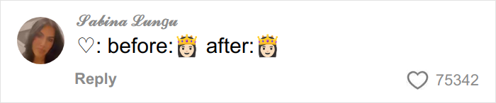 Woman showing before and after photos demonstrating a trick to hide loose skin on her belly after weight loss.