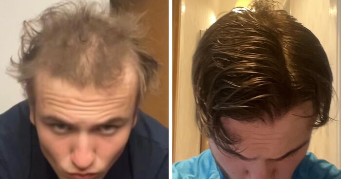 92 Times People Decided To Make A Change In Their Lives And Shared Pics Of Their Progress