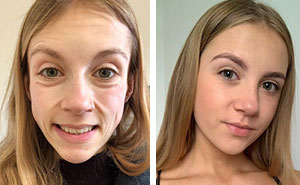 50 Times People Decided To Make A Change In Their Lives And Shared Pics Of Their Progress