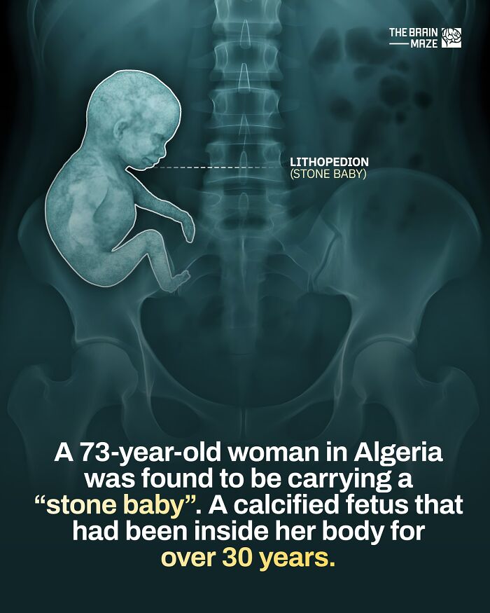 interesting-facts-brain-maze-692810d74e0