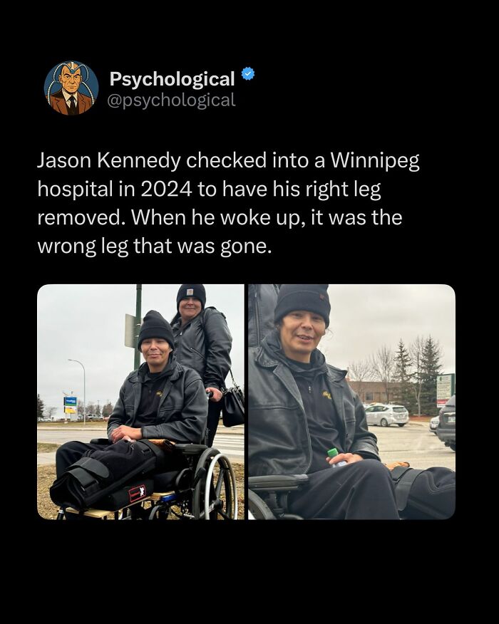 Tweet from Psychological sharing a daily fact about a man who lost the wrong leg after surgery, illustrating popular IG page content.