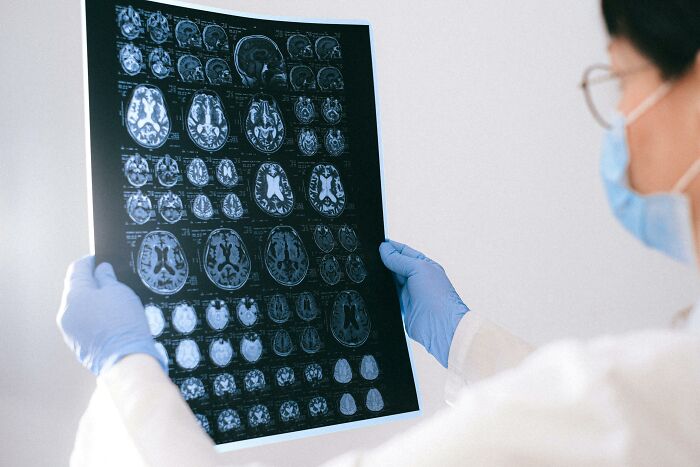 Scientist wearing gloves and mask examining brain scans related to dogs and autism research. Scientist wearing gloves and mask examining brain scans related to dogs and autism research.