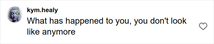 Comment on social media post criticizing appearance, referencing stretch marks on your skin in a public discussion. Comment on social media post criticizing appearance, referencing stretch marks on your skin in a public discussion.