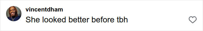 Screenshot of a social media comment reading She looked better before tbh, related to stretch marks on your skin conversation. Screenshot of a social media comment reading She looked better before tbh, related to stretch marks on your skin conversation.