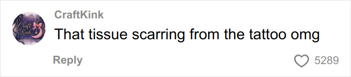 Comment about tissue scarring from a tattoo, reacting to a claim about a skinned body display in a Las Vegas museum. Comment about tissue scarring from a tattoo, reacting to a claim about a skinned body display in a Las Vegas museum.