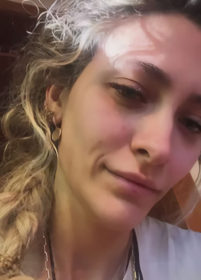Close-up of Paris Jackson showing effects of substance use that deformed her face, with natural lighting and relaxed expression. Close-up of Paris Jackson showing effects of substance use that deformed her face, with natural lighting and relaxed expression.