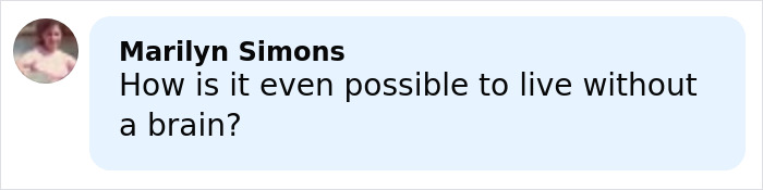Comment from Marilyn Simons questioning how it is possible to live without a brain, sparking debate online. Comment from Marilyn Simons questioning how it is possible to live without a brain, sparking debate online.