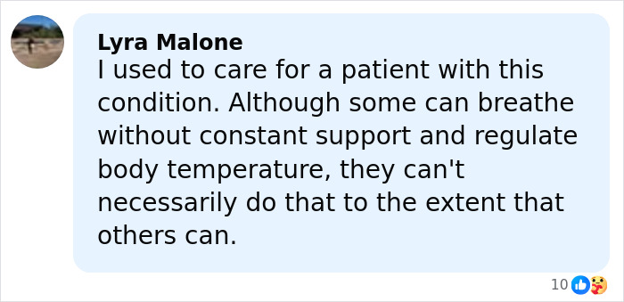 Comment about woman born without most of her brain, discussing care challenges and family perspectives sparking debate. Comment about woman born without most of her brain, discussing care challenges and family perspectives sparking debate.