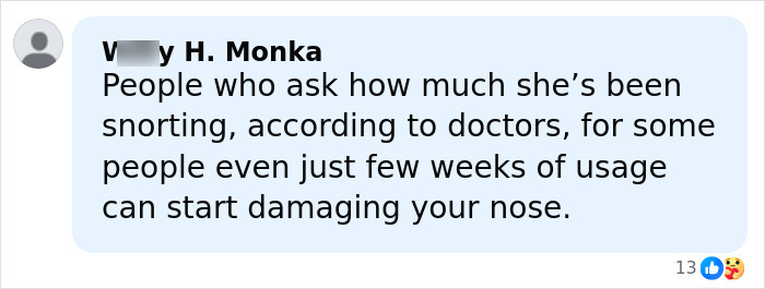 Comment discussing how substance use can damage the nose, related to Paris Jackson's face deformation reveal. Comment discussing how substance use can damage the nose, related to Paris Jackson's face deformation reveal.